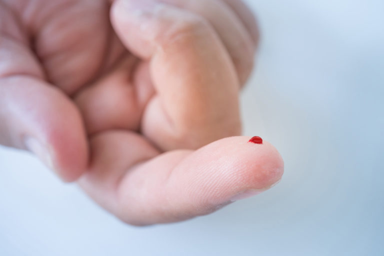 Lactate from finger